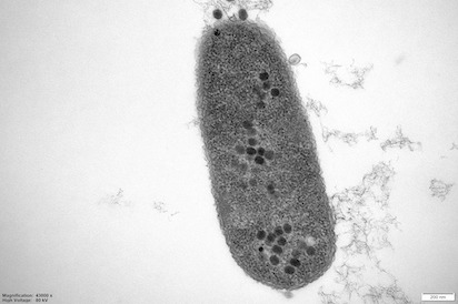bacteria 5000