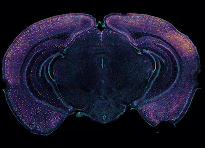 CEREBRO E INTESTINO UNA RELACIÓN CADA VEZ MÁS IMPORTANTE